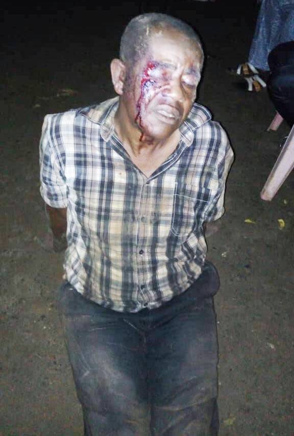 Police Commissioner Ngong James Kwanga tortured to death by separatists in Kumba